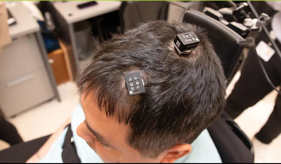 ایمپلنت مغزی هوشمصنوعی، حس و حرکت را در یک فرد فلج احیا کرد + فیلم بهبود فلج مغزی با ایمپلنت هوشمصنوعی